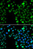 Immunofluorescence analysis of MCF-7 cells using ING5 Polyclonal Antibody