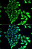 Immunofluorescence analysis of MCF-7 cells using MID1 Polyclonal Antibody