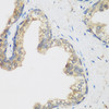 Immunohistochemistry of paraffin-embedded Human prostate using NCBP2 Polyclonal Antibody at dilution of  1:200 (40x lens).