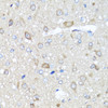 Immunohistochemistry of paraffin-embedded Rat brain using PRKAG1 Polyclonal Antibody at dilution of  1:100 (40x lens).