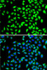 Immunofluorescence analysis of A-549 cells using SGTA Polyclonal Antibody