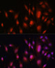 Immunofluorescence analysis of NIH/3T3 cells using TFEB Polyclonal Antibody at dilution of  1:100. Blue: DAPI for nuclear staining.