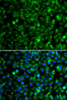 Immunofluorescence analysis of MCF-7 cells using TMLHE Polyclonal Antibody