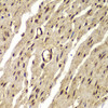 Immunohistochemistry of paraffin-embedded Human colon using PSMB8 Polyclonal Antibody at dilution of  1:100 (40x lens).