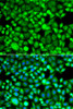 Immunofluorescence analysis of A549 cells using PSMB8 Polyclonal Antibody
