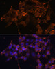 Immunofluorescence analysis of HeLa cells using PTGS1 Polyclonal Antibody at dilution of  1:100 (40x lens). Blue: DAPI for nuclear staining.