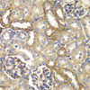 Immunohistochemistry of paraffin-embedded Rat kidney using RAB5C Polyclonal Antibody at dilution of  1:100 (40x lens).