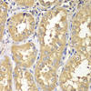 Immunohistochemistry of paraffin-embedded Human kidney using RAB5C Polyclonal Antibody at dilution of  1:100 (40x lens).