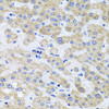 Immunohistochemistry of paraffin-embedded Human liver damage using PEX3 Polyclonal Antibody at dilution of  1:100 (40x lens).