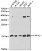 Western blot analysis of extracts of various cell lines using CHRAC1 Polyclonal Antibody at dilution of 1:1000.
