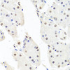 Immunohistochemistry of paraffin-embedded Human stomach using CHRAC1 Polyclonal Antibody at dilution of  1:100 (40x lens).