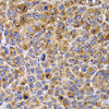 Immunohistochemistry of paraffin-embedded Mouse cancer using UBE2R2 Polyclonal Antibody at dilution of  1:100 (40x lens).