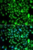 Immunofluorescence analysis of A549 cells using CSRP2BP Polyclonal Antibody