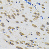 Immunohistochemistry of paraffin-embedded Rat brain using LGR6 Polyclonal Antibody at dilution of  1:100 (40x lens).