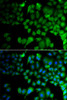Immunofluorescence analysis of A549 cells using JMJD7 Polyclonal Antibody