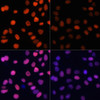 Immunofluorescence analysis of HeLa cells using Acetyl-Histone H4-K91 Polyclonal Antibody at dilution of  1:100.HeLa cells were treated by TSA (1 uM) at 37℃ for 18 hours. Blue: DAPI for nuclear staining.