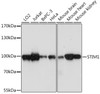 Western blot analysis of extracts of various cell lines using STIM1 Polyclonal Antibody at dilution of 1:1000.