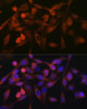 Immunofluorescence analysis of HeLa cells using STIM1 Polyclonal Antibody at dilution of  1:100. Blue: DAPI for nuclear staining.