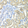 Immunohistochemistry of paraffin-embedded Rat kidney using NDUFV2 Polyclonal Antibody at dilution of  1:100 (40x lens).