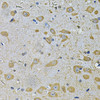 Immunohistochemistry of paraffin-embedded Rat brain using DAAM2 Polyclonal Antibody at dilution of  1:100 (40x lens).