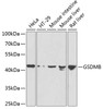 Western blot analysis of extracts of various cell lines using GSDMB Polyclonal Antibody at dilution of 1:1000.