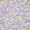 Immunohistochemistry of paraffin-embedded Mouse kidney using ASPSCR1 Polyclonal Antibody at dilution of  1:100 (40x lens).