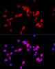 Immunofluorescence analysis of PC-12 cells using ASPSCR1 Polyclonal Antibody at dilution of  1:100 (40x lens). Blue: DAPI for nuclear staining.