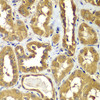 Immunohistochemistry of paraffin-embedded Human kidney using RAB1B Polyclonal Antibody at dilution of  1:100 (40x lens).