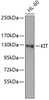 Western blot analysis of extracts of HL-60 cells using KIT Polyclonal Antibody.