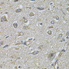 Immunohistochemistry of paraffin-embedded Human brain cancer using WIPI1 Polyclonal Antibody at dilution of  1:100 (40x lens).