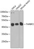 Western blot analysis of extracts of various cell lines using TARBP2 Polyclonal Antibody at dilution of 1:1000.