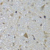 Immunohistochemistry of paraffin-embedded Mouse brain using CHN1 Polyclonal Antibody at dilution of  1:100 (40x lens).