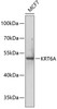 Western blot analysis of extracts of MCF-7 cells using KRT6A Polyclonal Antibody at dilution of 1:1000.