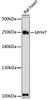 Western blot analysis of extracts of Rat heart using MYH7 Polyclonal Antibody at dilution of 1:1000.