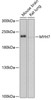 Western blot analysis of extracts of various cell lines using MYH7 Polyclonal Antibody at dilution of 1:1000.