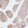 Immunohistochemistry of paraffin-embedded Mouse skeletal muscle using MYH7 Polyclonal Antibody at dilution of  1:100 (40x lens).