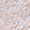 Immunohistochemistry of paraffin-embedded Mouse heart using MYH7 Polyclonal Antibody at dilution of  1:100 (40x lens).