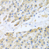 Immunohistochemistry of paraffin-embedded Human liver using CCL3 Polyclonal Antibody at dilution of  1:100 (40x lens).