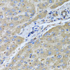 Immunohistochemistry of paraffin-embedded Human liver damage using UGT2B10 Polyclonal Antibody at dilution of  1:100 (40x lens).