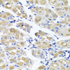 Immunohistochemistry of paraffin-embedded Human stomach using SPATA4 Polyclonal Antibody at dilution of  1:100 (40x lens).