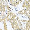 Immunohistochemistry of paraffin-embedded Rat heart using GLUT4 Polyclonal Antibody at dilution of  1:100 (40x lens).