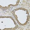 Immunohistochemistry of paraffin-embedded Human prostate using ANXA8L2 Polyclonal Antibody at dilution of  1:100 (40x lens).