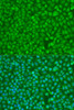 Immunofluorescence analysis of U2OS cells using CHEK1 Polyclonal Antibody at dilution of  1:100. Blue: DAPI for nuclear staining.