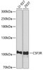 Western blot analysis of extracts of various cell lines using CSF3R Polyclonal Antibody at dilution of 1:1000.