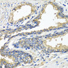 Immunohistochemistry of paraffin-embedded Human prostate using ETFA Polyclonal Antibody at dilution of  1:100 (40x lens).