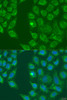 Immunofluorescence analysis of U2OS cells using HSD17B3 Polyclonal Antibody at dilution of  1:100. Blue: DAPI for nuclear staining.