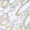 Immunohistochemistry of paraffin-embedded Human stomach using IL5 Polyclonal Antibody at dilution of  1:100 (40x lens).