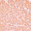 Immunohistochemistry of paraffin-embedded Rat ovary using MAP2K3 Polyclonal Antibody at dilution of  1:100 (40x lens).
