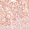 Immunohistochemistry of paraffin-embedded Mouse kidney using MAP2K3 Polyclonal Antibody at dilution of  1:100 (40x lens).