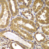 Immunohistochemistry of paraffin-embedded Human kidney using PSEN2 Polyclonal Antibody at dilution of  1:100 (40x lens).